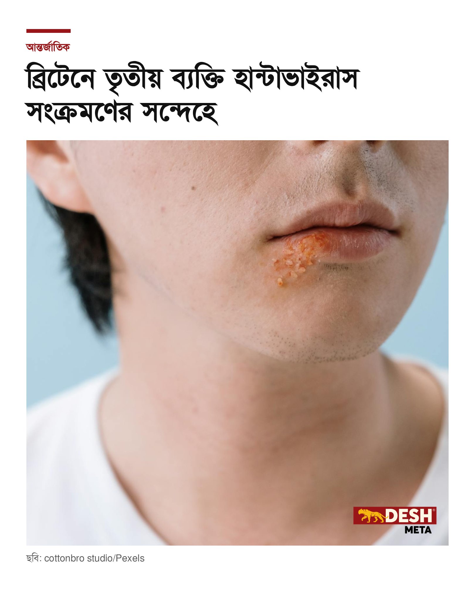 ব্রিটেনে তৃতীয় ব্যক্তি হান্টাভাইরাস সংক্রমণের সন্দেহে
