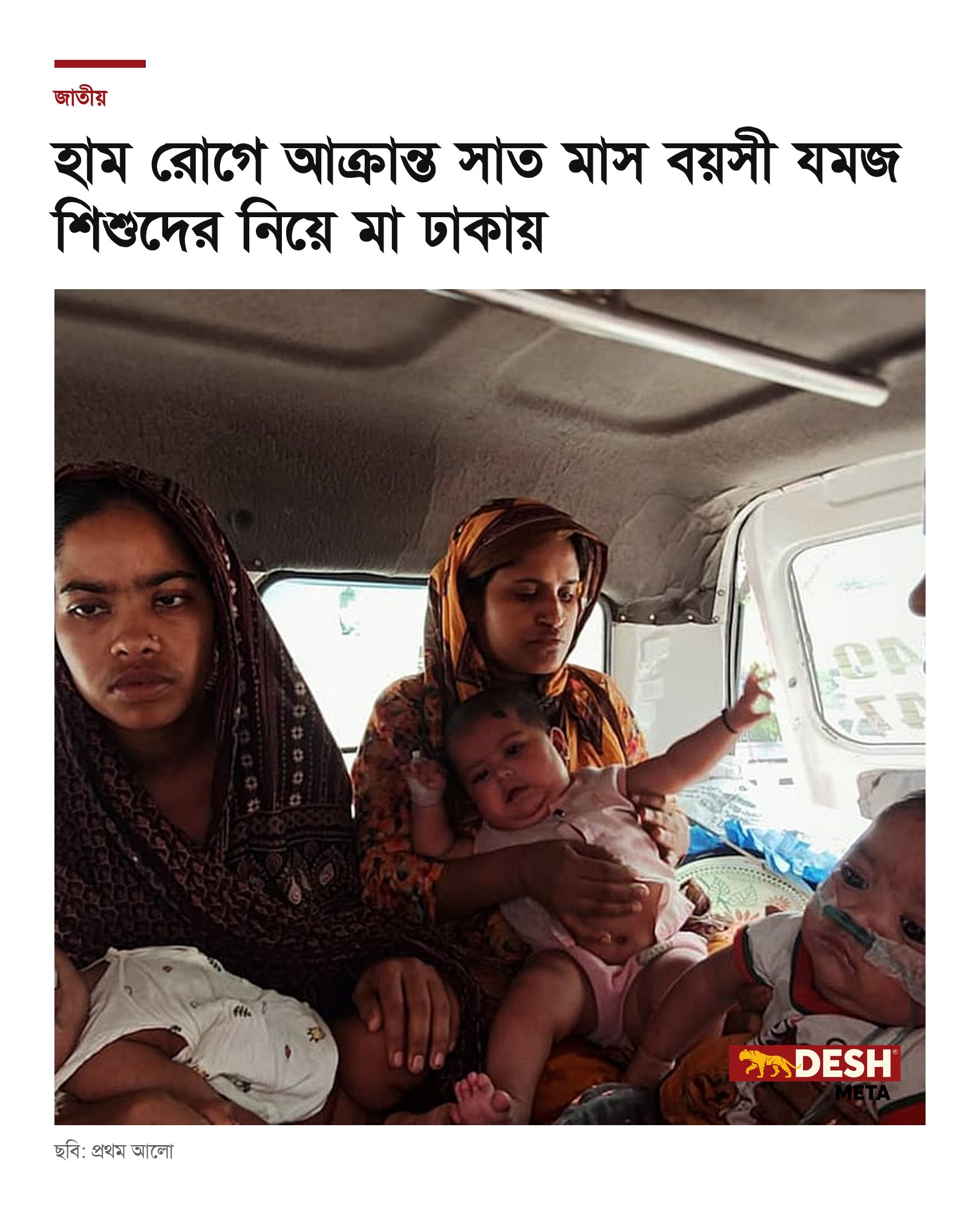 হাম রোগে আক্রান্ত সাত মাস বয়সী যমজ শিশুদের নিয়ে মা ঢাকায়