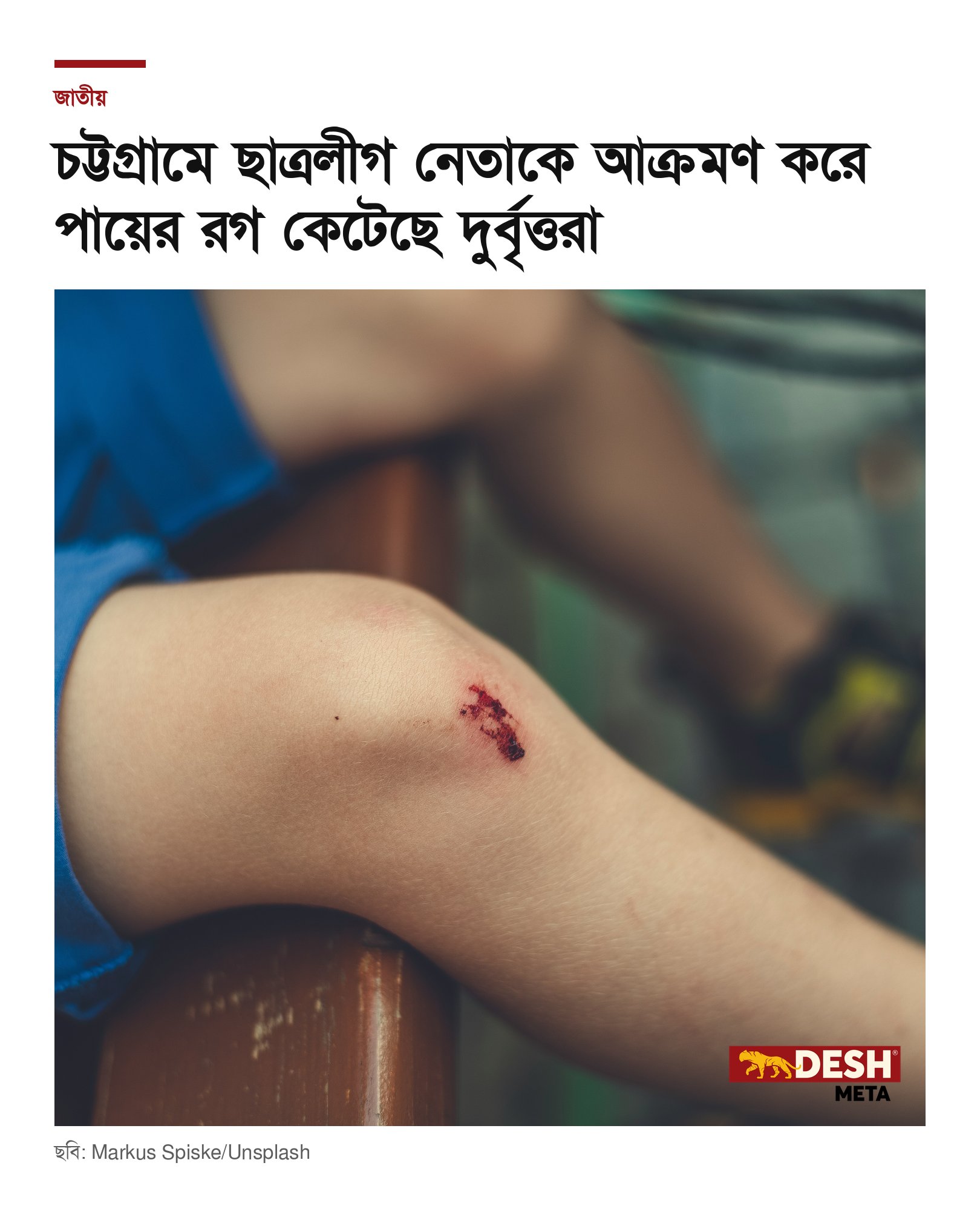 চট্টগ্রামে ছাত্রলীগ নেতাকে আক্রমণ করে পায়ের রগ কেটেছে দুর্বৃত্তরা