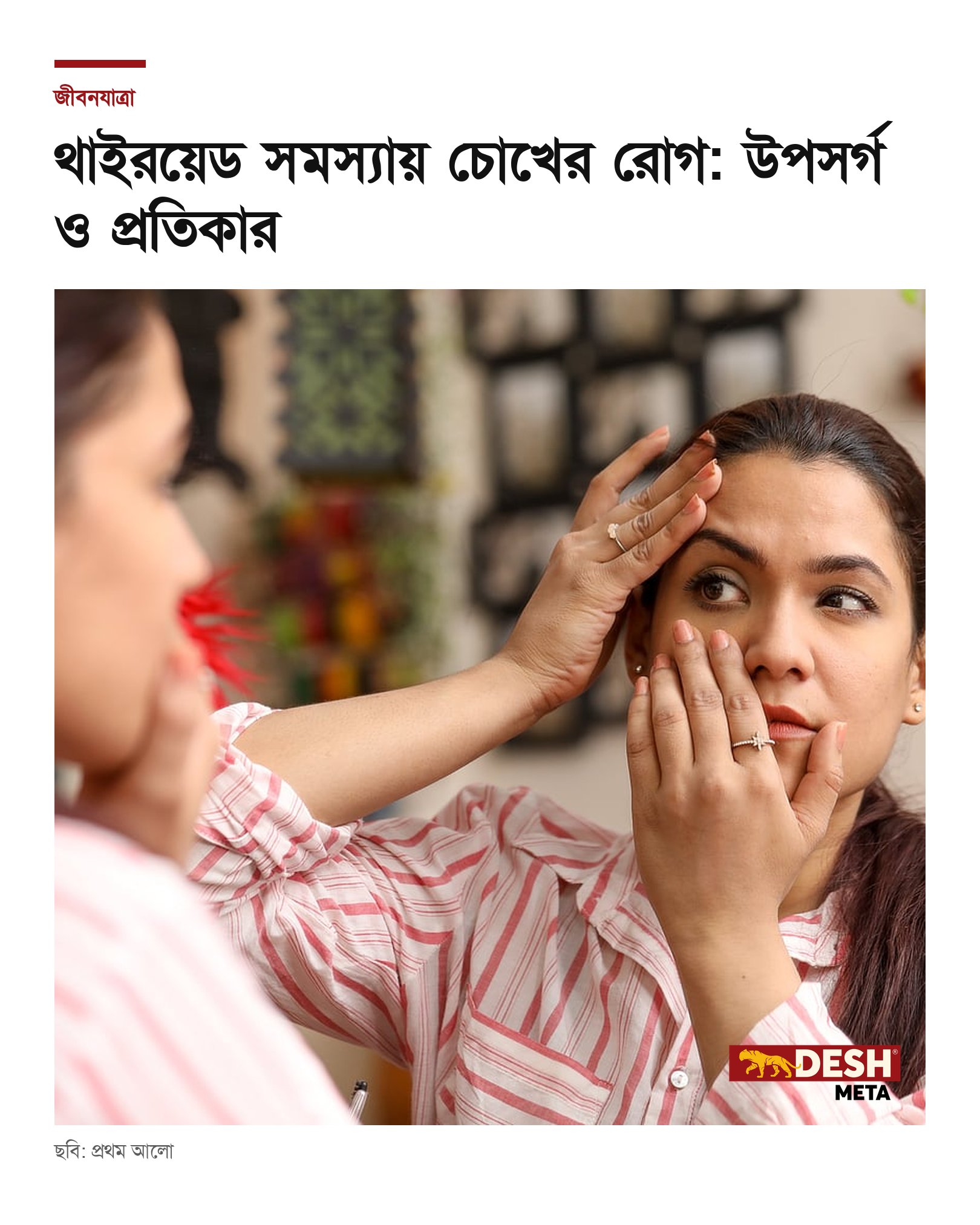 থাইরয়েড সমস্যায় চোখের রোগ: উপসর্গ ও প্রতিকার